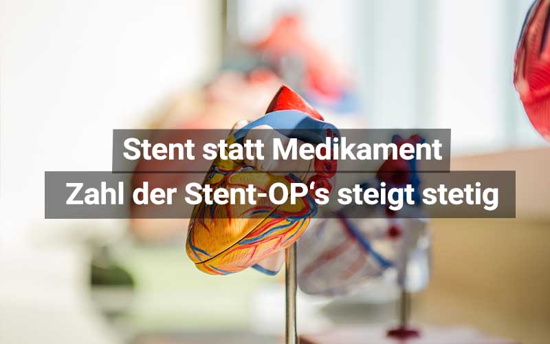 Stent OP Statt Medikamente