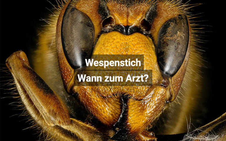 Wespenstich: Was tun und wann zum Arzt? | praktischArzt.ch