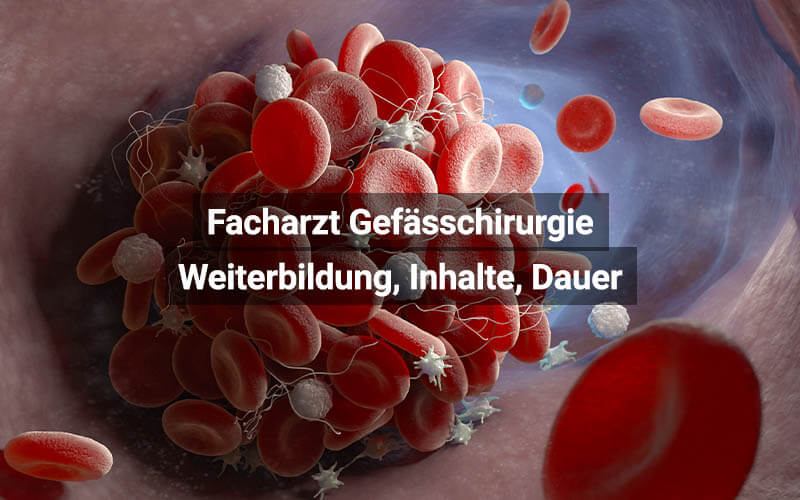 Facharzt Gefässchirurgie