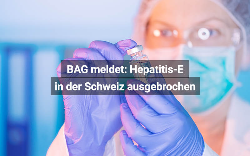 BAG Meldet Hepatitis-E In Der Schweiz Ausgebrochen