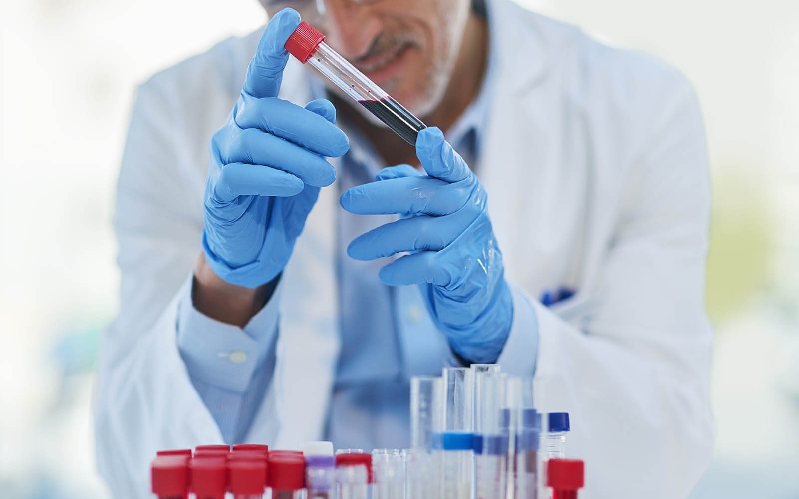 Weiterbildung Facharzt Hämatologie