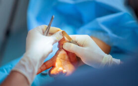 Weiterbildung Facharzt Handchirurgie