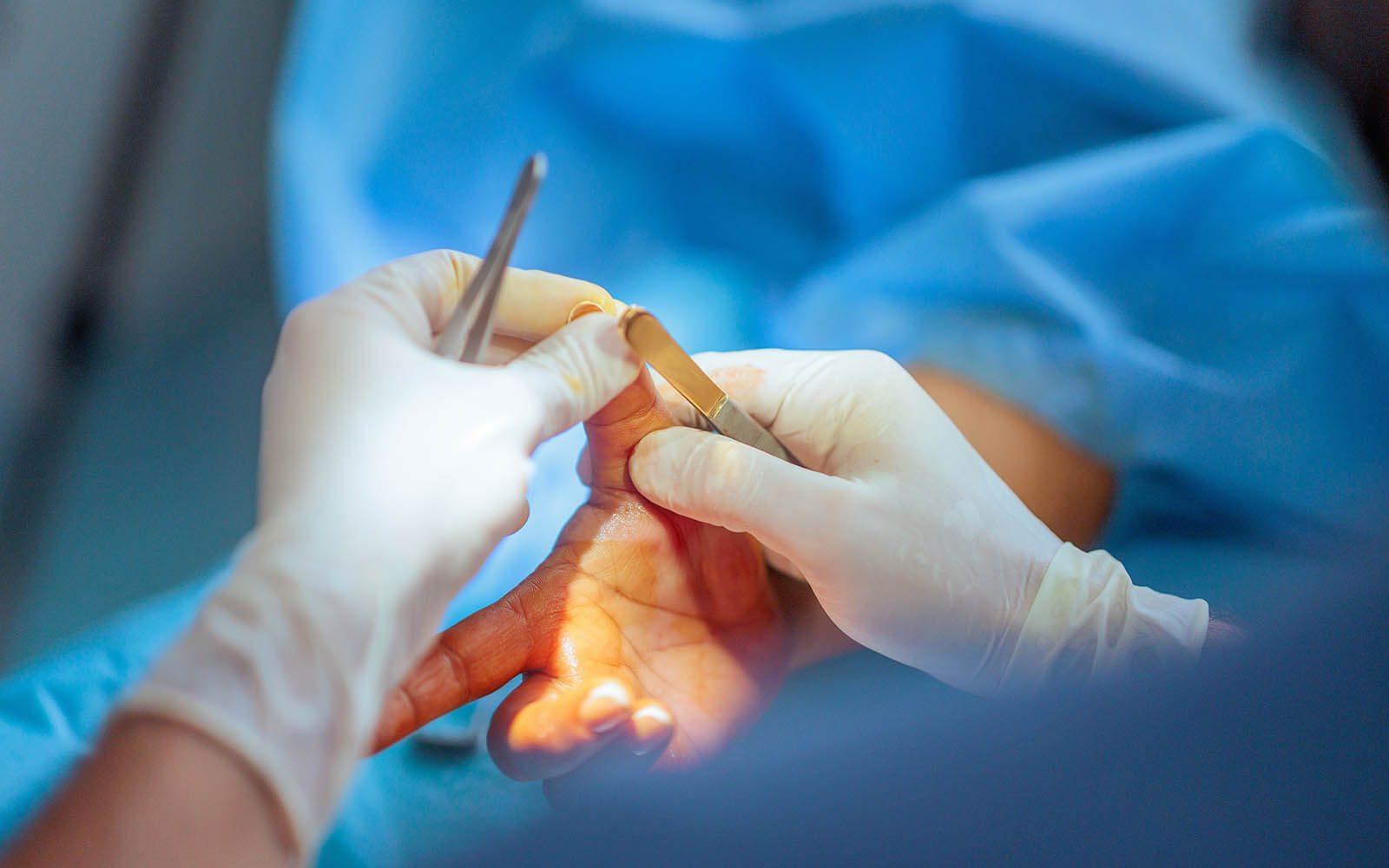 Weiterbildung Facharzt Handchirurgie