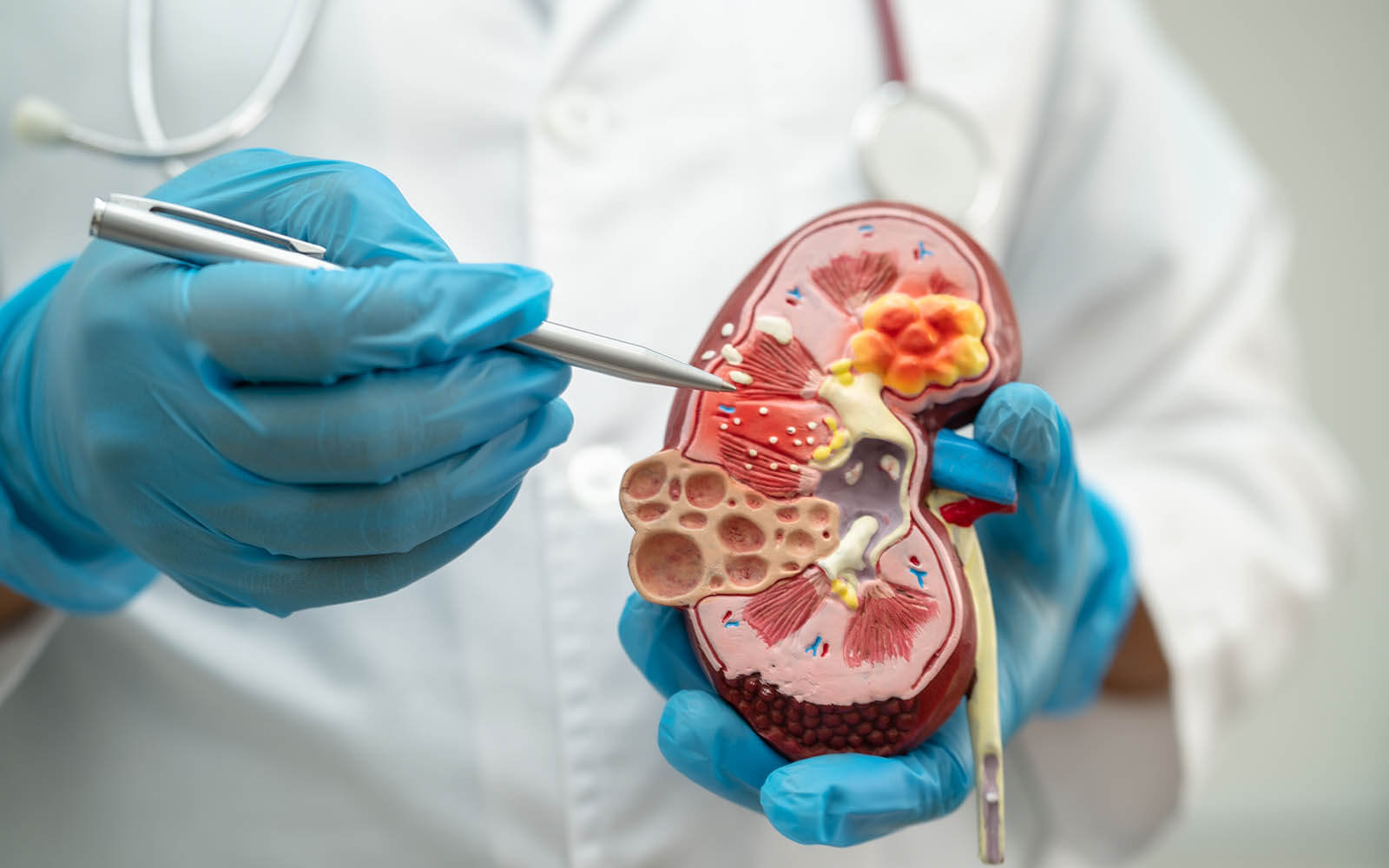 Weiterbildung Facharzt Nephrologie